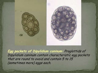 Lab Dx: eggs in stoolHookworm egg: oval or ellipsoid; thin shell; usually  embryo at four cell stage