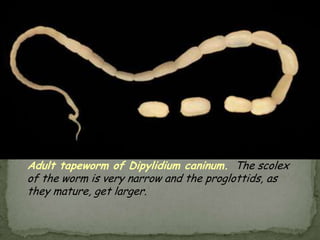 Hookworm rhabditiform larva (wet preparation).