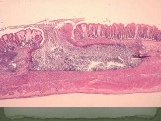 Cyst:4 nuclei in mature cyst; rod-like			chromatoid bodies 