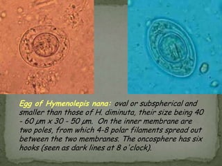 Infective stage: filariform larva