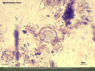 Sources of infection: infective filariform larvae in soil