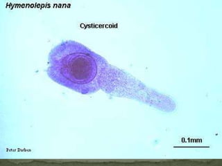 Lab Dx: eggs in stoolOral opening of Ancylostoma duodenale:presence of four cutting "teeth," two on each side.