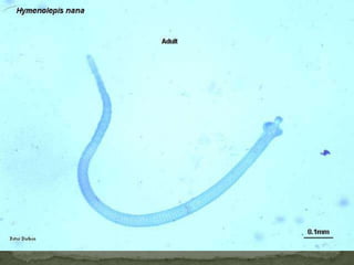 BAA: Adult worm of Ancylostoma duodenale.  Anterior end is depicted showing cutting teeth.B: Adult worm of Necator americanus.  Anterior end showing mouth parts with cutting plates.