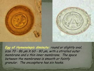 Causal Agents:The human hookworms include two nematode (roundworm) species, Ancylostomaduodenale and Necatoramericanus.  A smaller group of hookworms infecting animals can invade and parasitize humans (A. ceylanicum) or can penetrate the human skin (causing cutaneous larva migrans), but do not develop any further (A. braziliense, A. caninum, Uncinariastenocephala).  Occasionally A. caninum larva may migrate to the human intestine causing eosinophilic enteritis; this may happen when larva is ingested rather than through skin invasion.