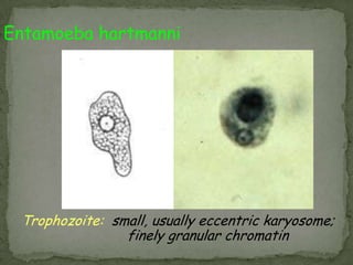 Gross pathology of liver containing amebic abscess  