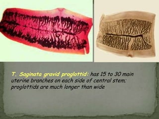 Case 1418-year-old trailer park handyman seen in ERWorked under trailers wearing shorts and no shirtDeveloped intensely pruritic skin rashUnable to sleepWBC 18,00065% eosinophils.