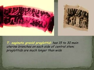 Case 15An 8 year old boyPresents with skin lesions and itching after spending the summer at a beach condo in St. Augustine with his family (mother, father, younger sister, dog and cat).Legs show several raised, reddened, serpiginous lesions that are intensely pruritic.