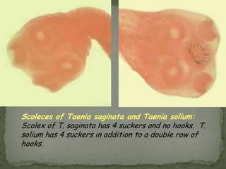 Cutaneous Larva MigransCaused by filariform larvae of dog or cat hookworm (Ancylostoma braziliense or Ancylostoma duodenaleCommon in Southeast U.S.Red papule at entry with serpiginous tunnelIntense pruritisSelf limiting conditionDiagnosis clinicalTopical or oral thiabendazole 25 mg/kg bid for 3-5 daysMay use ethyl chloride topically