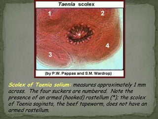 Cutaneous larva migrans (creeping eruption)More common in childrenLarvae penetrate skin and cause tingling followed by intense itching.Eggs shed from dog and cat bowels develop into infectious larvae outside the body in places protected from desiccation and extremes of temperatureShady, sandy areas under houses, at beach, etc.