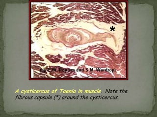 Cutaneous larva migrans (creeping eruption)Usually not associated with systemic symptoms 