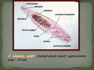 Lab Dx: eggs in stool