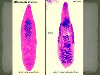 Eggs of D. latum:oval or ellipsoidal, with at one end an operculum that can be inconspicuous.  At the opposite (abopercular) end is a small knob that can be barely discernible.  
