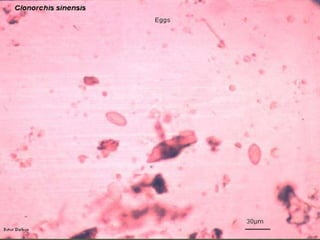 D. latum scolex and gravid proglottids