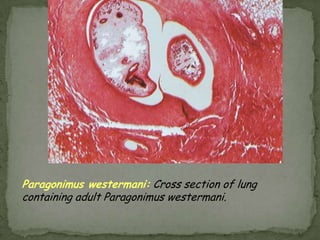 Infective stage: eggs 