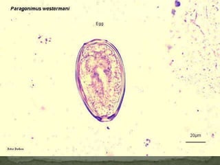 Sources of infection: flea & louse