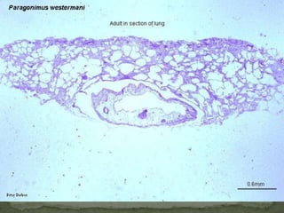 Lab Dx: eggs in stool or egg sacks in stoolEgg of Dipylidium caninum:round to oval (average size 35 to 40 µm) and contain an oncosphere that has 6 hooklets. Ovum contains hexacanth wmbryo (8-15 ova are usually enclosed within sac-like membrane) 