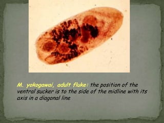Clinical Features:Most infections with Dipylidiumcaninum are asymptomatic.  Pets may exhibit behavior to relieve anal pruritis (such as scraping anal region across grass or carpeting).  Mild gastrointestinal disturbances may occur.  The most striking feature in animals and children consists of the passage of proglottids.  These can be found in the perianal region, in the feces, on diapers, and occasionally on floor covering and furniture.  The proglottids are motile when freshly passed and may be mistaken for maggots or fly larvae.