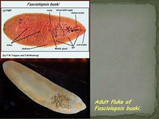 HYMENOLEPIS DIMINUTADisease: Hymenolepiasis; rat tapeworm infection