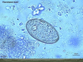 Definitive host: human, mice & rats