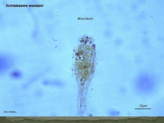 Mature proglottids of Hymenolepis diminuta. 