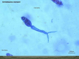 Causal Agents:Hymenolepiasis is caused by two cestodes (tapeworm) species, Hymenolepis nana (the dwarf tapeworm,) and Hymenolepisdimnuta (rat tapeworm).  Hymenolepisdiminuta is a cestode of rodents infrequently seen in humans and frequently found in rodents.Geographic Distribution:Hymenolepis nana is the most common cause of all cestode infections, and is encountered worldwide.  In temperate areas its incidence is higher in children and institutionalized groups.  Hymenolepisdiminuta, while less frequent, has been reported from various areas of the world.