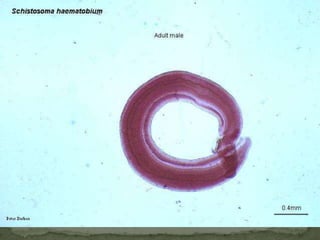Treatment:Diagnostic findingsMicroscopyTreatment:Praziquantel* is the drug of choice. 
