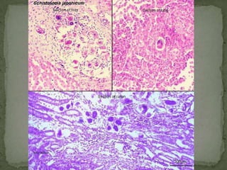 Taeniid eggs: rounded or subspherical, diameter 31 to 43 µm, with a thick radially striated brown shell.  Inside each shell is an embryonated oncosphere with 6 hooks (hexacanth embryo).  