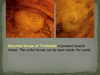 TAENIA SOLIUMDisease: Taeniasis; pork tapeworm infection