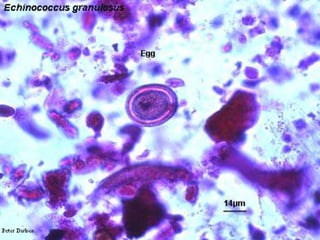 Sources of infection: cysts in pork; autoinfection