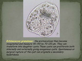 Scoleces of Taenia saginata and Taenia solium: Scolex of T. saginata has 4 suckers and no hooks.  T. solium has 4 suckers in addition to a double row of hooks. 