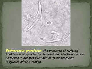 A cysticercus of Taenia in muscle.  Note the fibrous capsule (*) around the cysticercus.