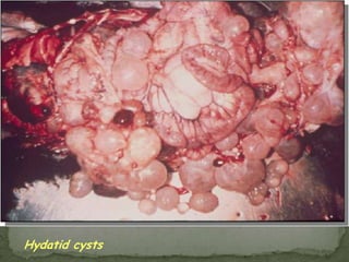 Causal Agents:The cestodes (tapeworms) Taeniasaginata (beef tapeworm) and T. solium (pork tapeworm).  Taeniasolium can also cause cysticercosis.Geographic Distribution:Both species are worldwide in distribution.  Taeniasolium is more prevalent in poorer communities where humans live in close contact with pigs and eat undercooked pork and is very rare in Muslim countries