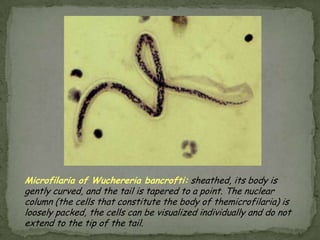 Diagnostic findingsTAKE EXTREME CARE IN PROCESSING THE SAMPLES!  INGESTION OF EGGS CAN RESULT IN CYSTICERCOSIS!Microscopy Antibody detection may prove useful especially in the early invasive stages, when the eggs and proglottids are not yet apparent in the stools.Treatment:Treatment is simple and very effective.  Praziquantel* is the drug of choice. 