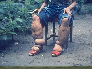 TreatmentPraziquantelAlbendazoleNiclosamide