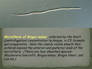 CysticercosisDiagnosisCT and MRI preferred studiesDiscrete cysts that may enhanceUsually multiple lesionsSingle lesions especially common in cases from IndiaOlder lesions may calcifyCSFLymphs or eos, low glucose, elevated proteinSerologyEspecially in cases with multiple cysts
