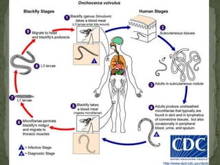 Disease: Fascioliasis, “liver rot”