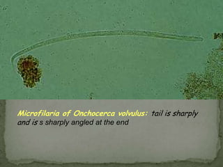 Site in host: Bile ducts