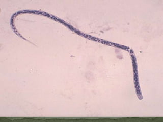 Portal of entry: mouth