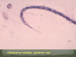 Definitive host: sheep, cattle & other mammals, including humans