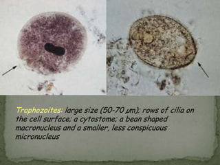 Lab Dx: cysts/trophs in stoolCILIATES