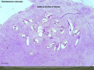 Intermediate host: snail (Lymnaea)