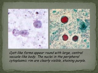 Cyst: spherical to oval; cilia present in the young cyst but are absent in older forms; large, kidney-shaped macronucleus & contractile vacuoles in cytoplasm 