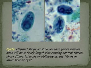 metronidazoleor iodoquinolTreatment: