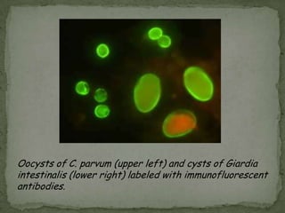 Transmission: contaminated food or water by person to person contact