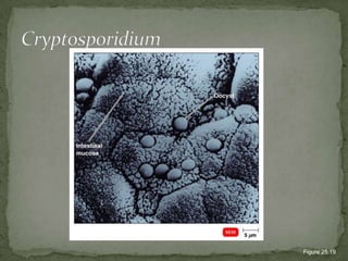 CryptosporidiumFigure 25.19