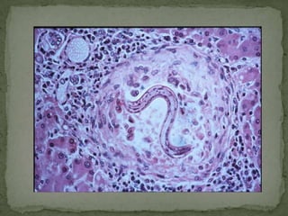 Infective stage: ova containing rhabditiform larva