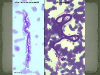 Beef Tapeworm<br />