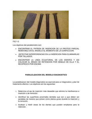 FIG 1-2
Los objetivos del paralelometro son:
   •   ENCONTRAR EL PATRON DE INSERCION DE LA PROTEIS PARCIAL
       REMOVIBLE EN EL MODELO AL MOMENTO DE LA CONFECCION.
   •   .DETECTAR INTERFERENCIAS EN LA INSERCION PARA ELIMINARLAS
       POR TALLADOS,
   •   ENCONTRAR LA LINEA ECUATORIAL DE LOS DIENTES Y ASI
       COLOCAR EL BRAZO DE RETENCION POR DEBAJO DE ELLA Y EL
       RECIPROCO POR ENCIMA




               PARALELIZACION DEL MODELO DIAGNOSTICO


La paralelizacion del modelo diagnostico es esencial para un diagnostico y plan de
tratamiento efectivo. Los objetivos son los siguientes:


   1. Determina el eje de inserción más deseable que elimine la interferencia e
       inserción o de remoción.
   2. identificar las superficies proximales dentales que son o que deben ser
       paralelas de manera que actúen como planos guías durante la inserción y
       la remoción.
   3. localizar y medir áreas de los dientes que pueden emplearse para la
       retención.
 