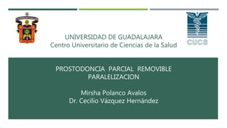 UNIVERSIDAD DE GUADALAJARA
Centro Universitario de Ciencias de la Salud
PROSTODONCIA PARCIAL REMOVIBLE
PARALELIZACION
Mirsha Polanco Avalos
Dr. Cecilio Vázquez Hernández
 