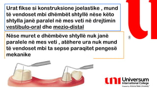 paralelometri dhe aplikimi i tij në stomatologji | PPTX